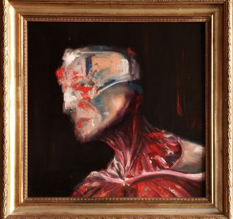 Thomas D WrightPeeled, Anatomy